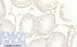FoxO3A (phospho Ser253) Polyclonal Antibody